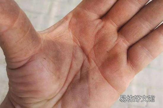 吃核桃手黑怎么洗掉