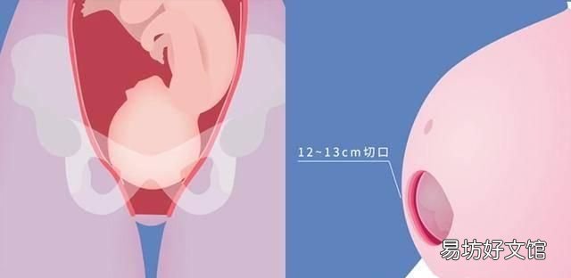 顺产前流程和剖腹产全流程对比 顺产最难熬的是什么时候