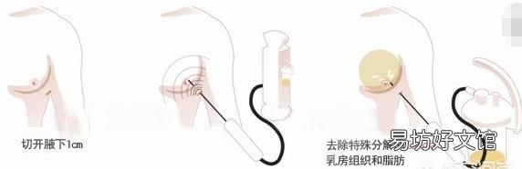 怎么可以让胸部变小,怎么可以让胸部变小点