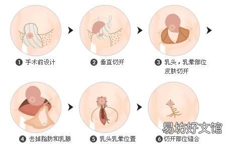 怎么可以让胸部变小,怎么可以让胸部变小点