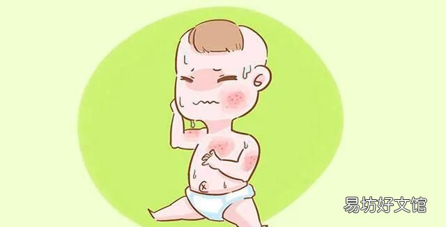农村蚊虫太多咬小孩子,没有蚊子却有很多像蚊子叮咬的包