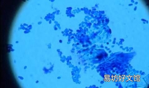 猫有耳螨怎么办