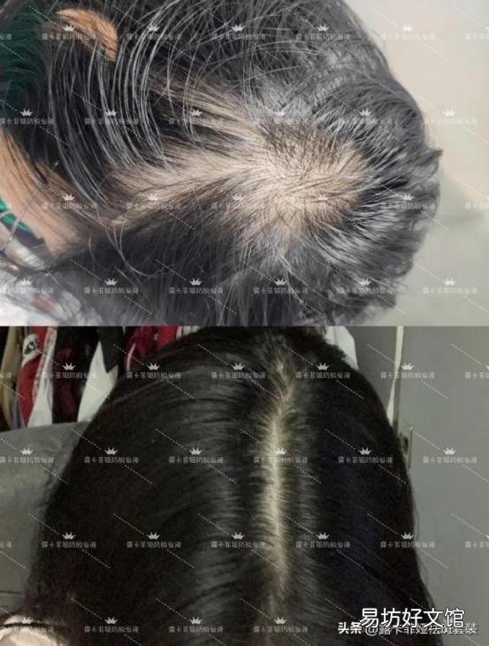 全国口碑最好的5款洗发水推荐 洗发水排行榜前十名品牌