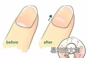 指甲上没有月牙是怎么回事儿 指甲上没有月牙是怎么回事