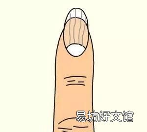 指甲上没有月牙是怎么回事儿 指甲上没有月牙是怎么回事