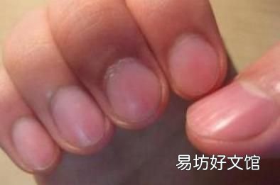 指甲上没有月牙是怎么回事儿 指甲上没有月牙是怎么回事