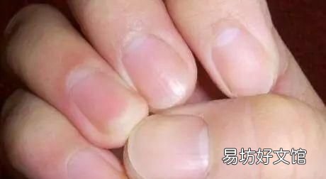 指甲上没有月牙是怎么回事儿 指甲上没有月牙是怎么回事