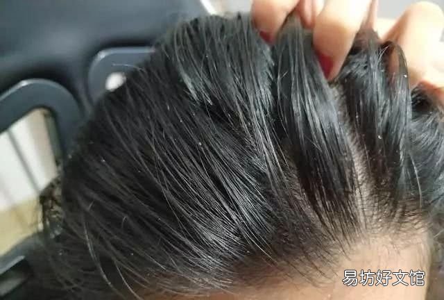怎么有效的除螨 如何有效的除螨面部