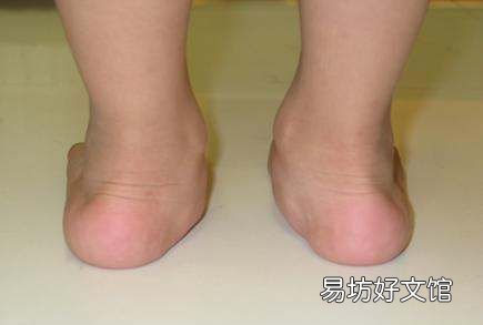 走路外八正常,刚学会走路的小孩走路外八厉害怎么办