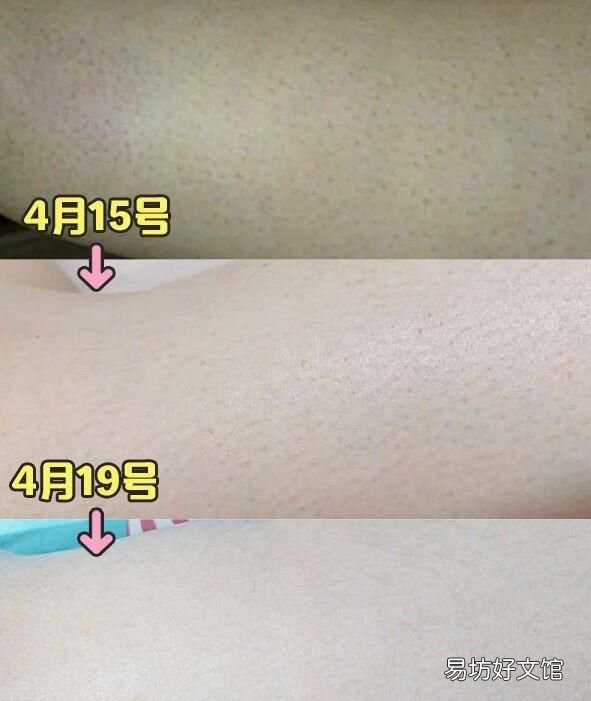 脸上皮肤不光滑怎么办