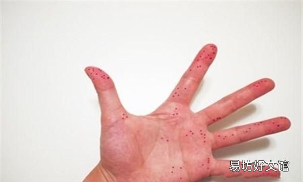 切辣椒辣到手怎么办,切辣椒辣到手怎么办最有效的方法