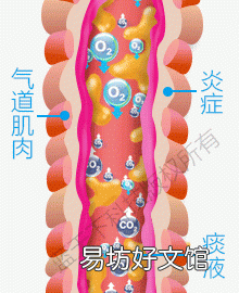 肺梗是什么病,什么是慢性阻塞性肺病