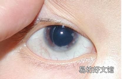 消毒灯对眼睛的伤害 【关灯后玩手机会造成青光眼吗