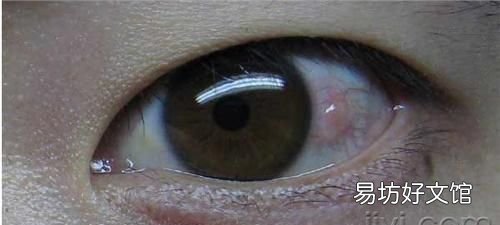 消毒灯对眼睛的伤害 【关灯后玩手机会造成青光眼吗