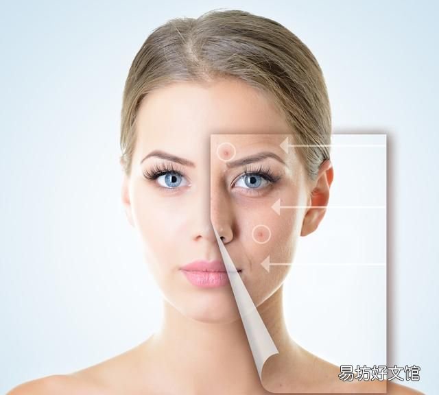 痤疮的症状 皮肤科吴医生带你了解一下年轻人患痤疮的症状
