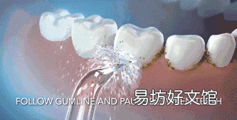 水牙线能替代传统牙线吗