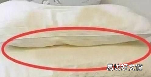 枕头发黄是什么原因,枕头套发黄是怎么回事