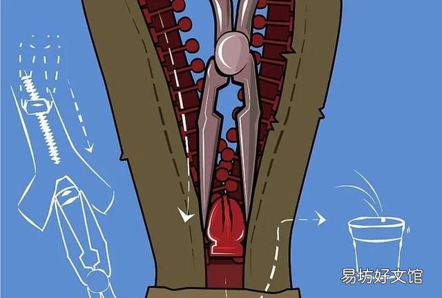 拉链头布头烂了怎么办：拉锁怎么办？