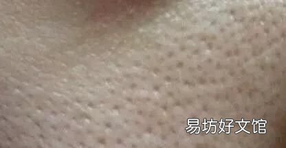 毛孔特别粗大 毛孔粗大怎么办?