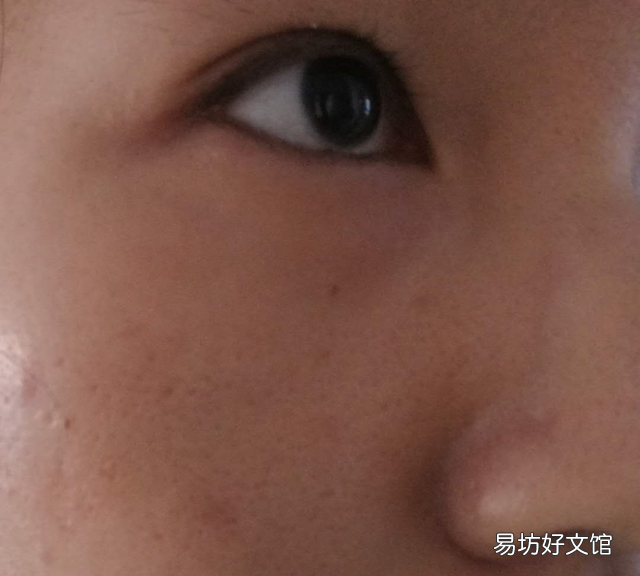 适合油痘肌的四大神水
