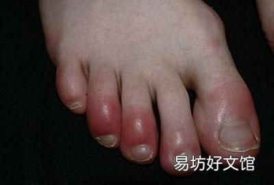 桃树冬天防冻措施,我们应该如何防治冻伤呢?