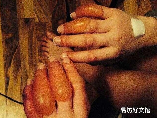 桃树冬天防冻措施,我们应该如何防治冻伤呢?