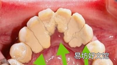 硬邦邦的什么,牙齿旁边硬硬的东西是什么