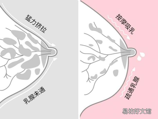 吸奶器的正确使用方法和误区 吸奶器使用手法教程图解