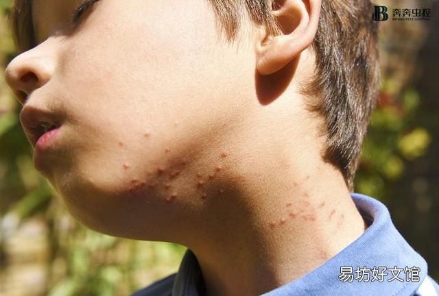 宿舍臭虫哪来的臭虫最怕3个克星 集体宿舍的臭虫最佳防治方法