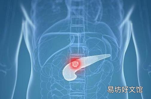 胰腺炎死亡率高达70% 胰腺炎发病给人体发出的警报