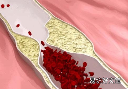 脸色发红是血脂堵塞了血管 血脂过高的人常有的表现