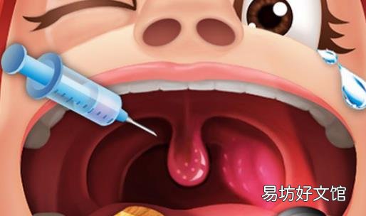 扁桃体结石需要安全护理 扁桃体结石形成原因及危害