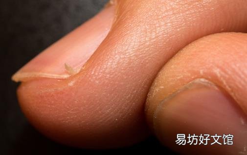 冬天手指周围总是长倒刺 到底是不是缺乏维生素