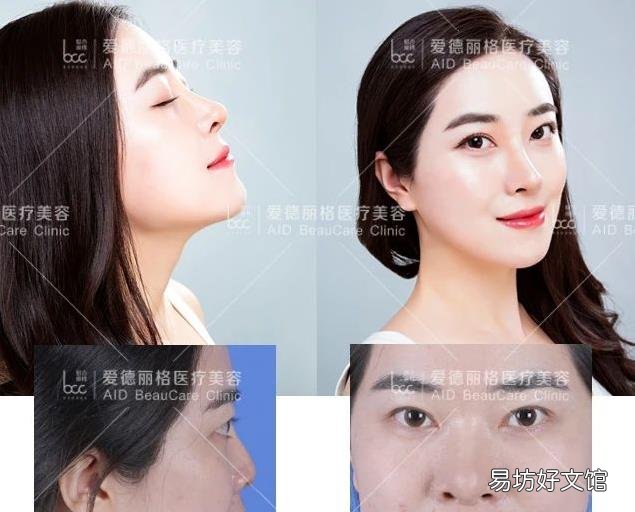 大连爱德丽格“你好美鼻”免费鼻部模特招募活动完美落幕