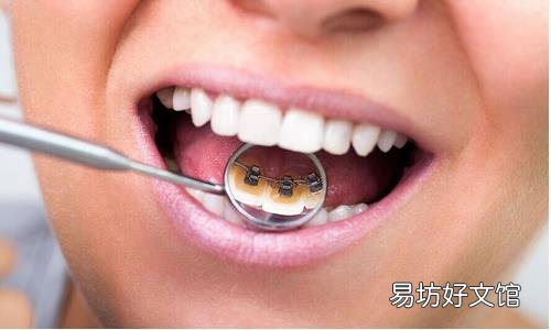 牙齿矫正有危害?修正两大错误认识
