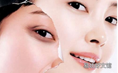 電波拉皮除皺有什么優勢