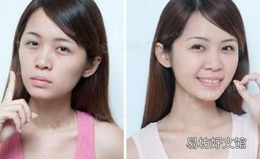 自体脂肪垫下巴术后如何护理?