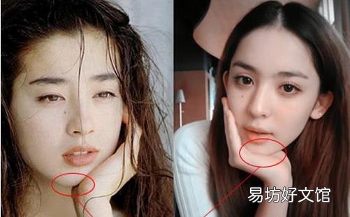 盘点90后喜欢的整形项目