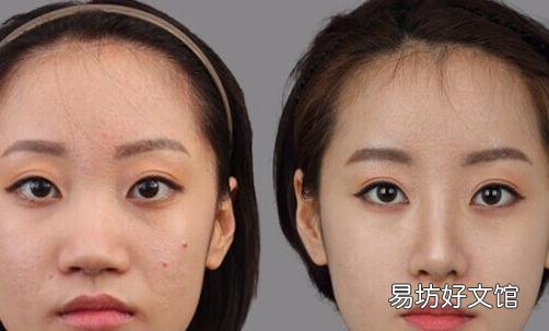 鼻翼整形术前6大禁忌 不可忽视