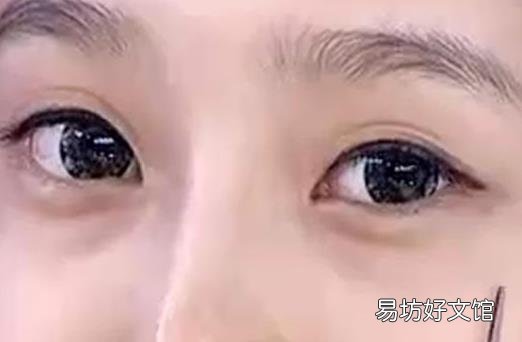 眼袋可不是卧蚕 它是怎么形成的