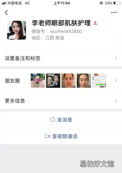 君雅笔记：眼袋过重，就会显得比真实年龄大，要如何修复眼袋呢？