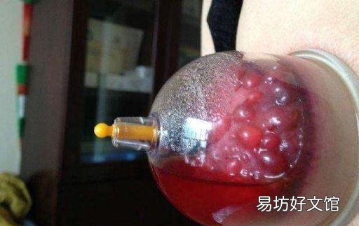 三九天可以拔罐吗 三九天可以艾灸吗