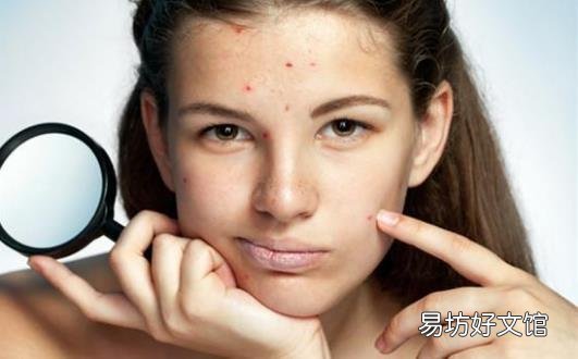 祛痘印小窍门学起来 帮助女性恢复俏佳人的本色