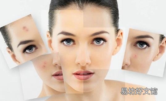 祛痘印小窍门学起来 帮助女性恢复俏佳人的本色