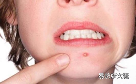 祛痘印小窍门学起来 帮助女性恢复俏佳人的本色