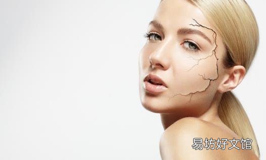 敏感性皮肤的特点 改善敏感皮肤方法