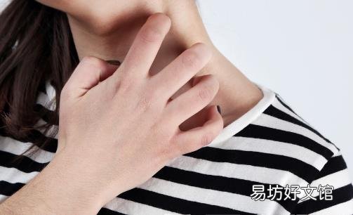 皮炎轻松解决方法 皮炎人群的日常护理法则
