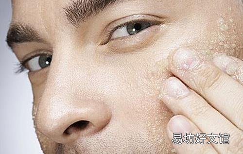 男人消除黑眼圈的六个小方法