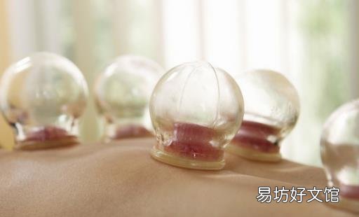 拔火罐并非人人适合 有的人拔火罐等于在自残