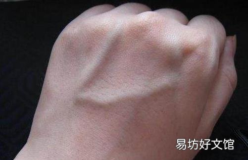 手上青筋说明身体有湿气 不同部位青筋显示不同问题